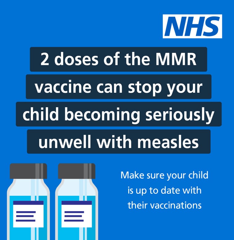 Measles